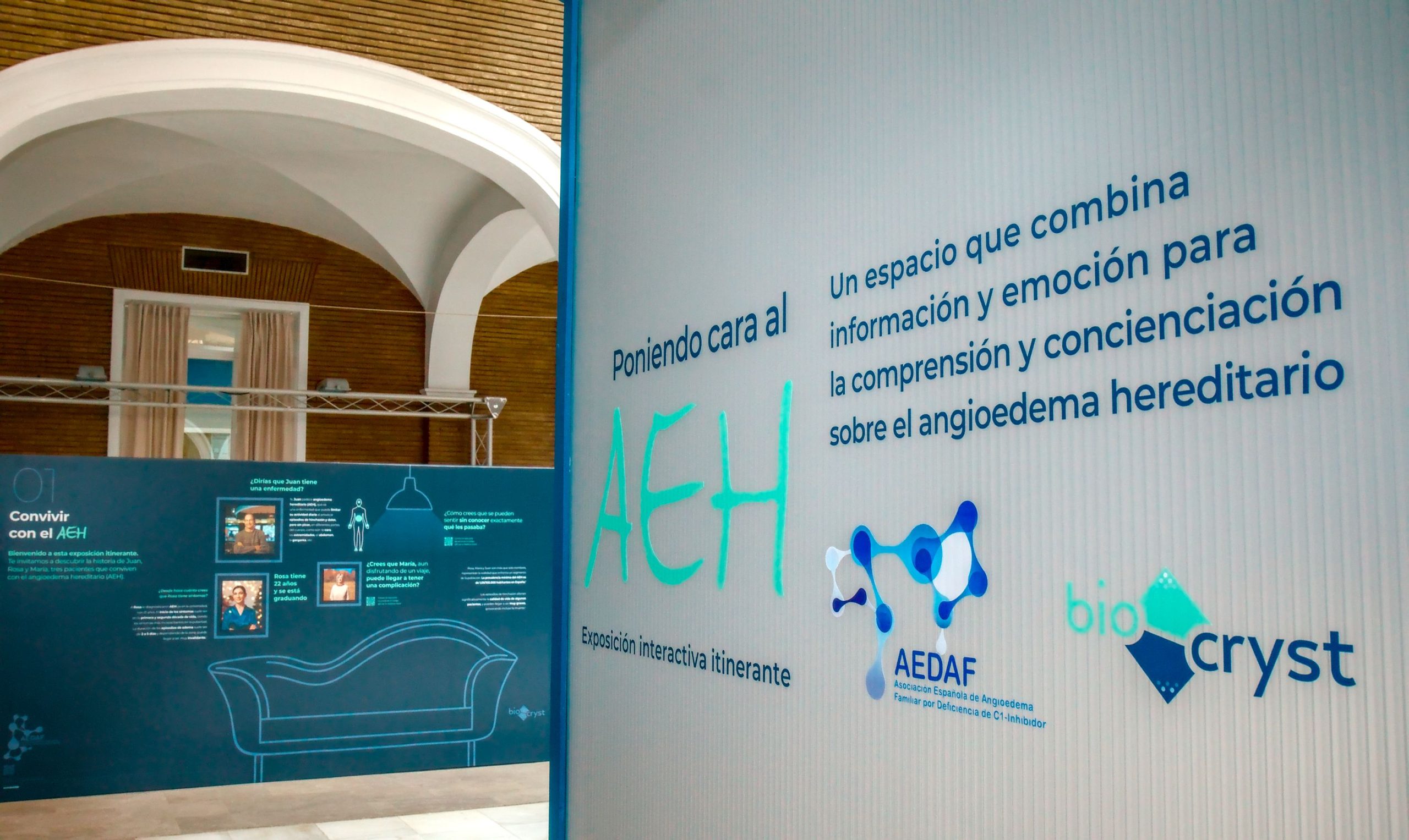 Exposición interactiva Angioedema. Alergología Hospital Universitario Virgen del Rocío, Sevilla
